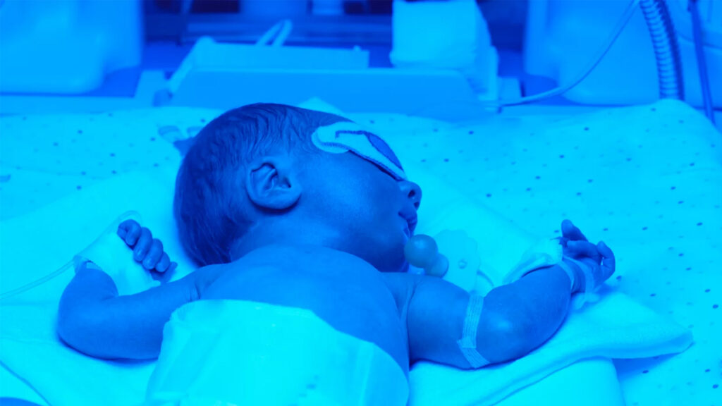 Blue light is used to treat neonatal jaundice