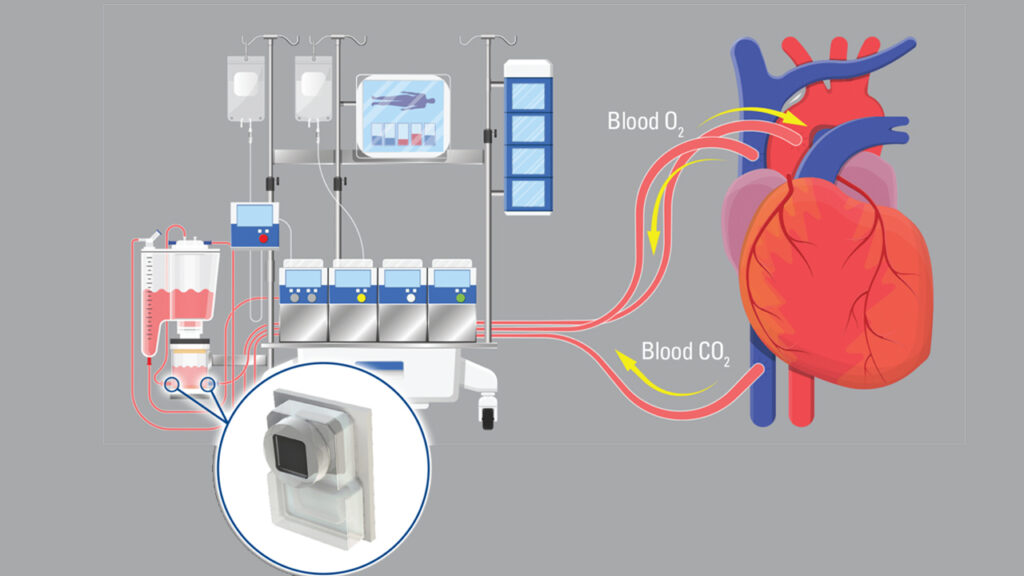 pressure sensor in medical equipment